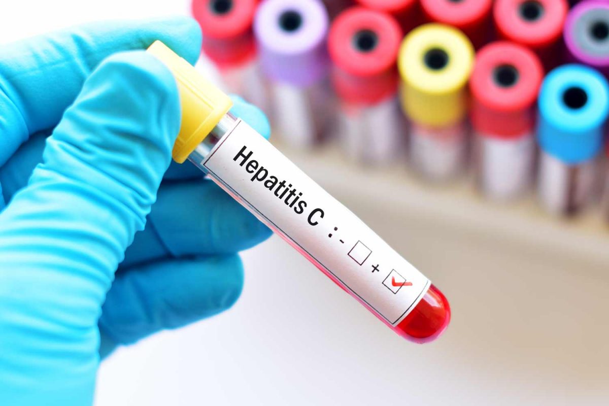 Pesquisador de Araraquara cria 1ª molécula que elimina todas as etapas do vírus da hepatite C