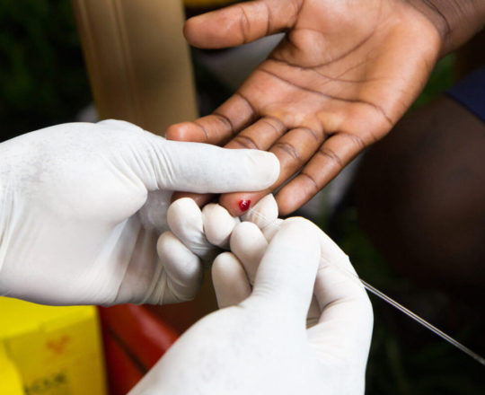 Teste rápido de HIV: saiba o resultado em 30 minutos.