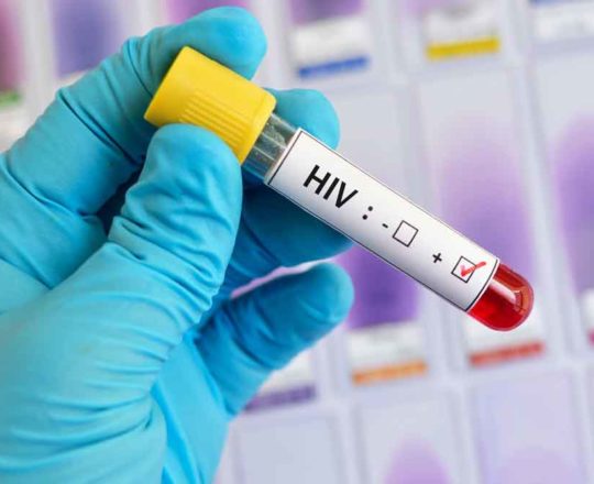 Brasil não cumpre metas da ONU sobre HIV; teor de campanhas pode explicar