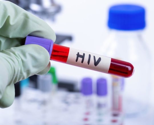 SUS oferece acesso a testes rápidos e gratuitos de HIV